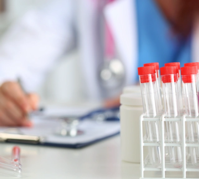 Provette da laboratorio in primo piano, sullo sfondo un medico compila documenti.